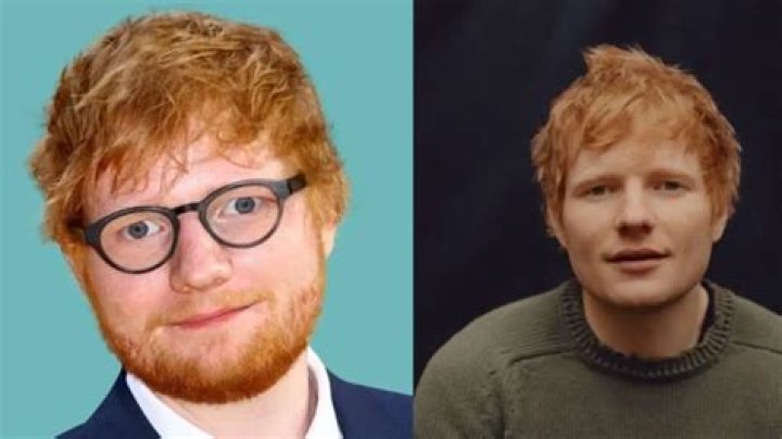 Despite Being Speculated To Have Undergone Plastic Surgery, Ed Sheeran Said That He Would Never Choose To Change His Looks No Matter What The World Says About Him!
