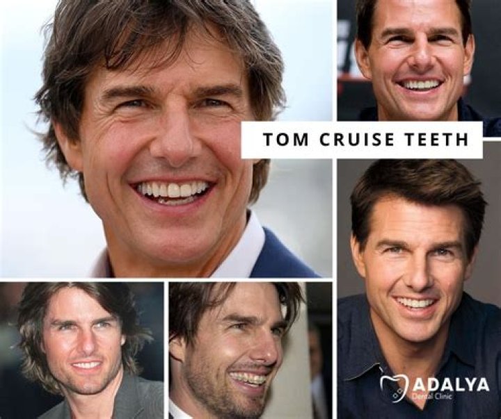 Does Tom Cruise Wear Dentures? + MORE About Tom's Teeth